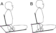 A concept for independent pelvic rotation. Actuating the parallelogram in the sagittal plane imposes pelvis posterior- (A) and anterior tilt (B).